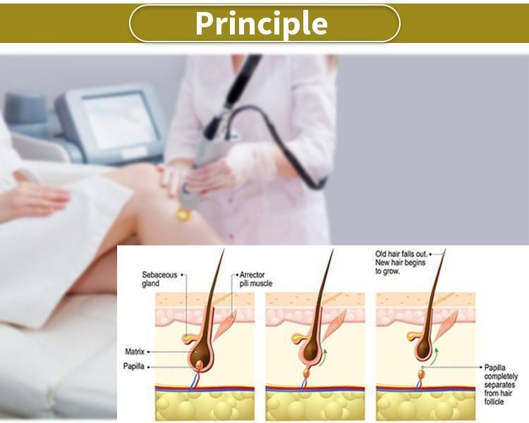 Jo. CE Approved Any Color Skin Need Long Pulse Laser Alex 1064 Nm Hair Removal Equipment