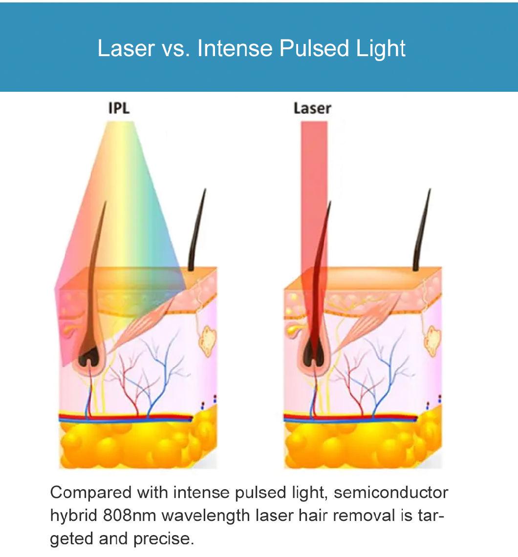 808nm pH Diode Laser Hair Removal Beauty Machine High Customer Comfort, Fixed Wavelength, More Precise Effect on The Skin