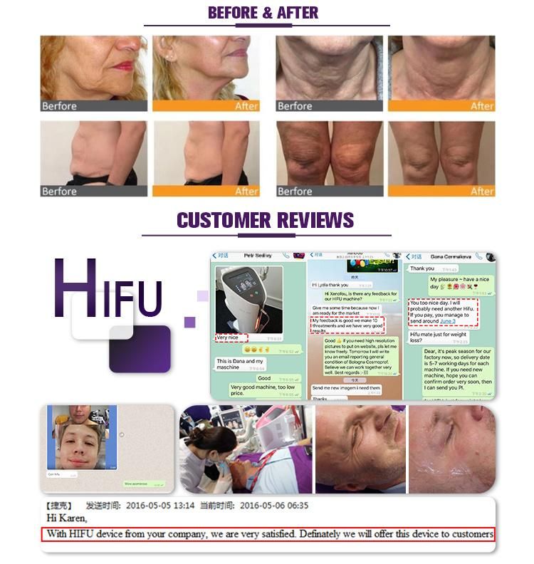 Good Quality Face Lifting Skin Rejuvenation Beauty Machine Feedback by Customers Hifu Machine 4D