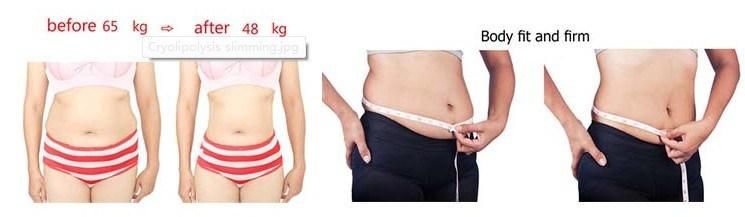 Hottest 4 Cryo Handles Work Together Fat Freezing Machine Permanent Body Slimming Equipment