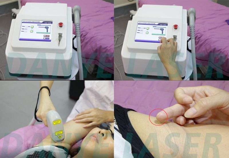 Lady Hair Remover Armpits 808nm Diode Laser Epilator