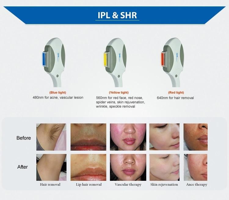 Advanced up-Rated Opt Shr System IPL Hair Removal Machine