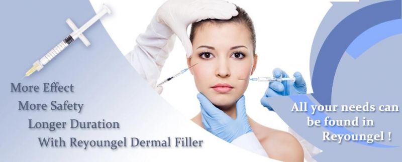 Cross Linked Hyaluronic Acid Filler Injection for The Face