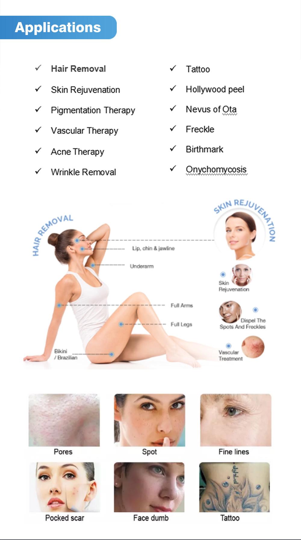 IPL Opt Shr RF ND YAG Laser Body Hair Removal Machine Skin Whitening Skin Rejuvenation for Men Devices