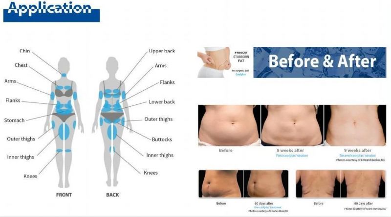 Cellulite Reduction and Fat Reduction Coolplas for Body Shaping