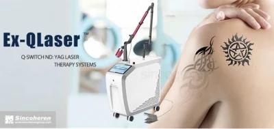 Tattoo Removal Q Switch Laser