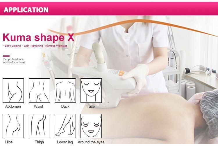 Sincoheren Best Ultrasound Vacuum Radio Frequency Cavitation Body Slimming Cellulite Removal Body Shape Face Lift Kuma Shape X Machine