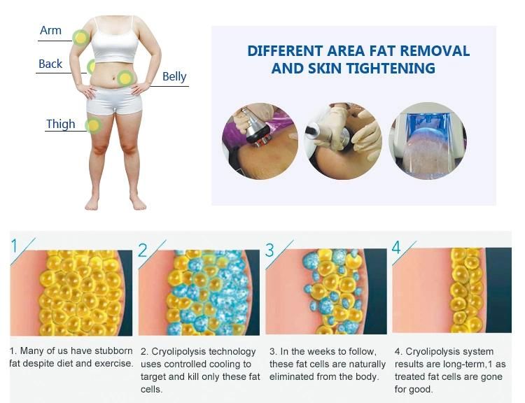 Body Weight Loss Fat Freezing Cryolipolysis Cavitation Slimming Beauty Equipment