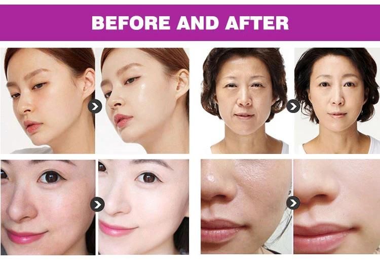 Hot Sale Ultrasonic Deep Cleaning Face Skin Scrubber for Face Lifting