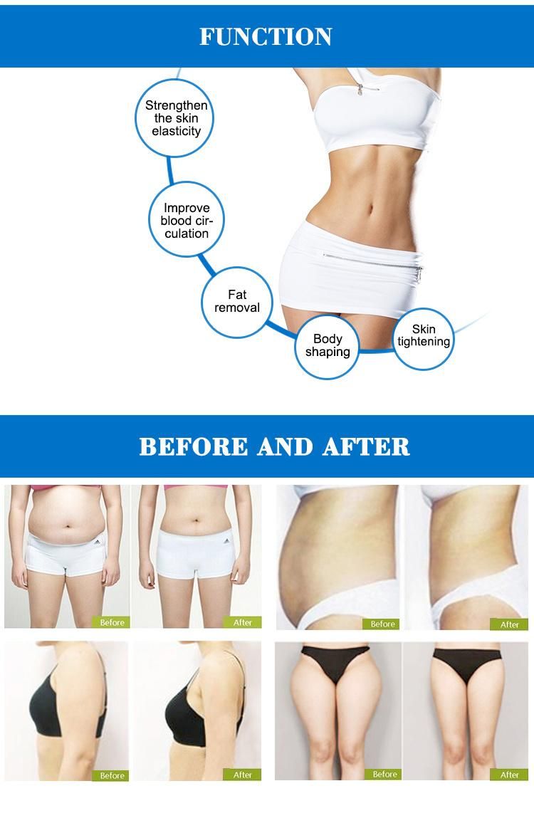 Hot Wholesale Cryo Lipo Weight Loss Machine