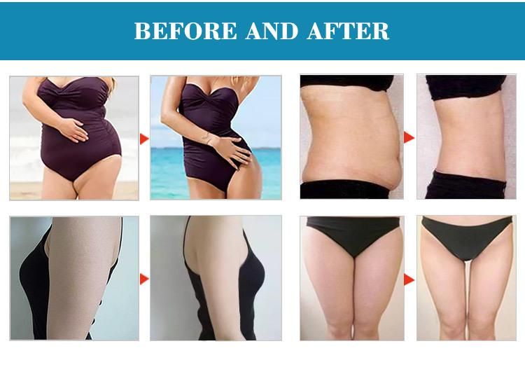 Good Performance Portable Cryo Lipo Beauty Device