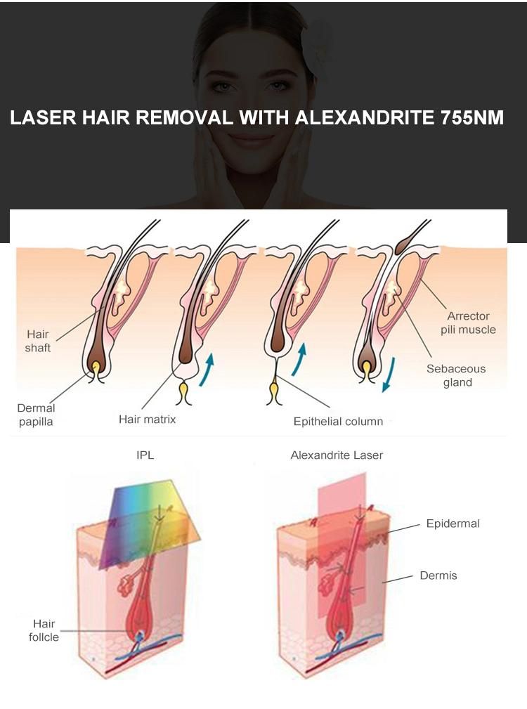 1600W Long Pulsed Fiber Laser Alexandrite 755nm Laser Hair Removal Hair Removal Machine Alexandrite ND YAG Laser Long Pulse Laser