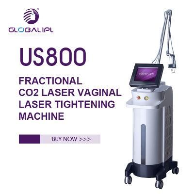 Globalipl Fractional Laser CO2 Vaginal Tightening Big RF Tube 40W Gynecology Laser Medical Beauty Equipment