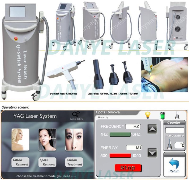 Economical Machine Q Switch Laser Tattoo Remover ND YAG Tender Skin laser Tattoo Equipment