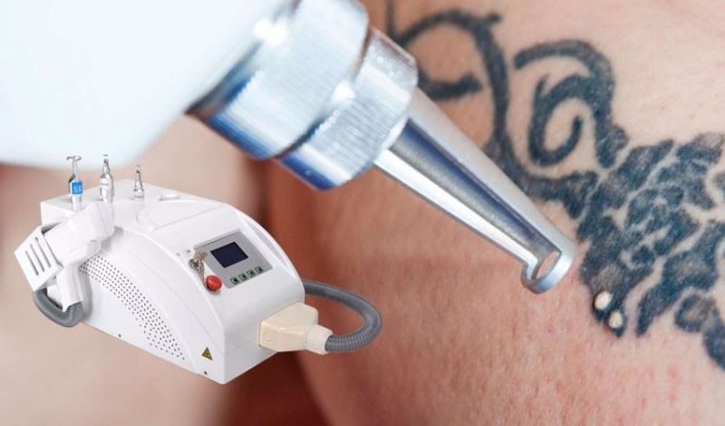 Portable ND: YAG Laser Q-Switch Medical Equipment Tattoo Removal