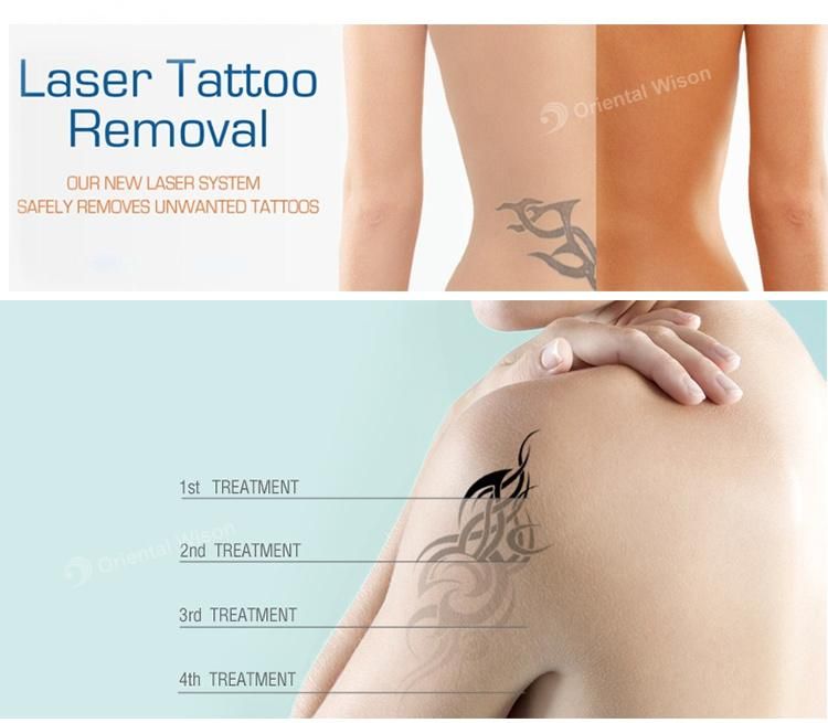 Picocare Q Switched ND YAG Laser Picosecond Laser Tattoo Removal Lutron Tatto Removal Pico Laser Spectra Tattoo Remove 450PS Picolaser Dark Spot Removing Tattoo