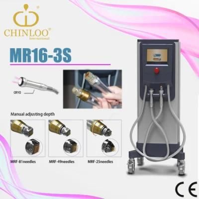 Guangzhou Skin Beauty and Pores Improve RF Radiofrequency Machine (MR16-3S)