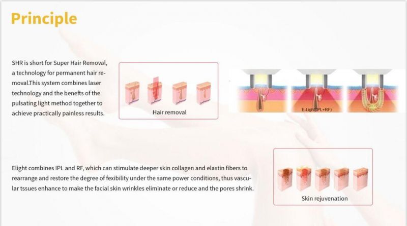 Skin Care Beauty Salon Equipment Shr / IPL Laser Machine Permanent Beauty Equipment Health Hair Removal