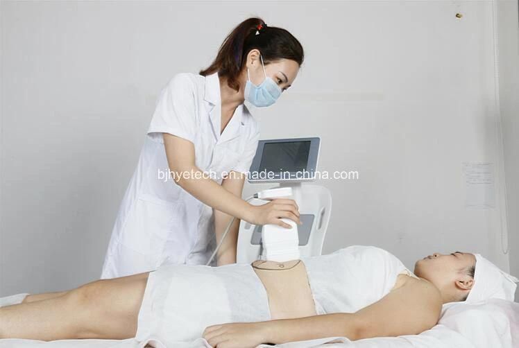 Liposonix Hifu Ultrasound Fat Reduction Machine Weight Loss Machine