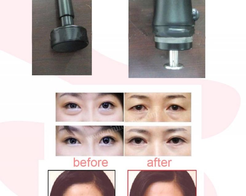 GS8.8 Needle Free Mesotherapy Machine Mini Cosmetic Vacuum Machinery for Skin Rejuvenation