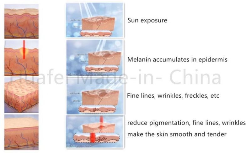 Visiable Before After Contrast Gold Standard CO2 Laser Medical Machine