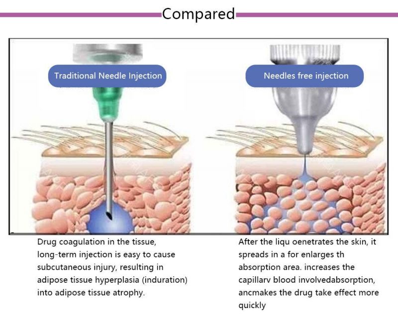 Needle Free Filler Injection Hyaluronic Acid Pen