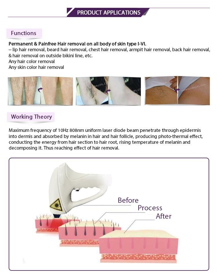 Laser Treatment Hair Removal Beauty Machine