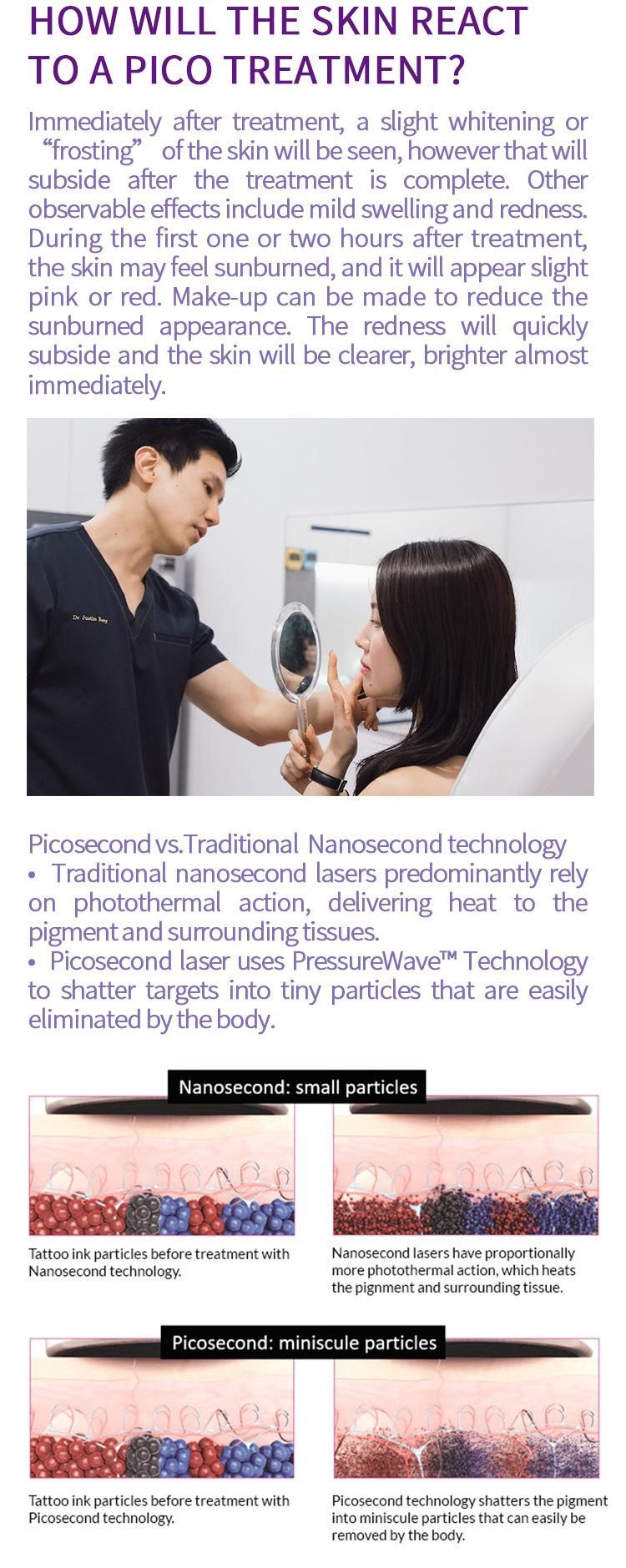 Q-Switched ND: YAG Picosecond Laser Machine Tattoo Removal Laser Machine Suitable for All Color Tattoo