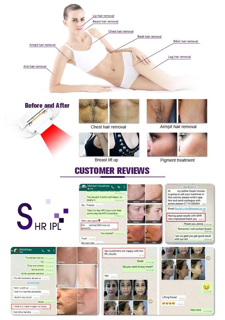 FDA Approved! 2 in 1 Powerful IPL Laser Shr /IPL Hair Removal Machines/IPL Opt Shr for Hair and Skin Treatment Beauty Machine