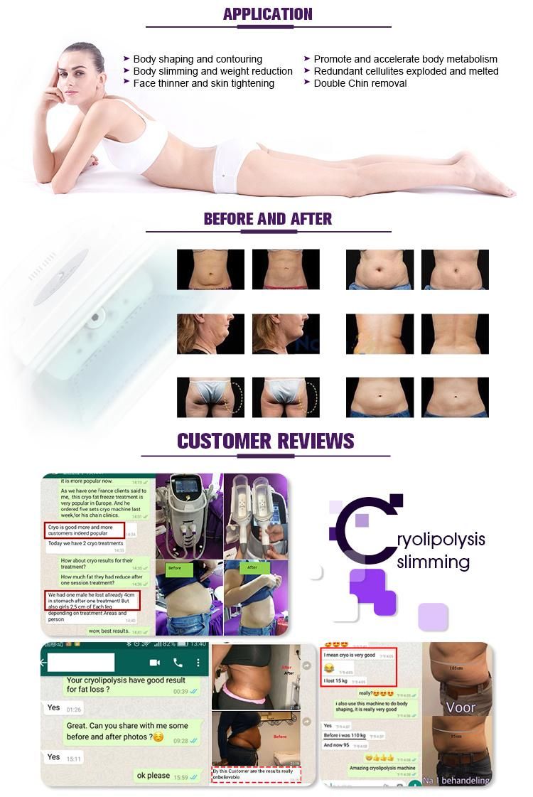 High Quality Cryo Pad Cryolipolysis Double Chin Fat Reduction Machine Body Slimming