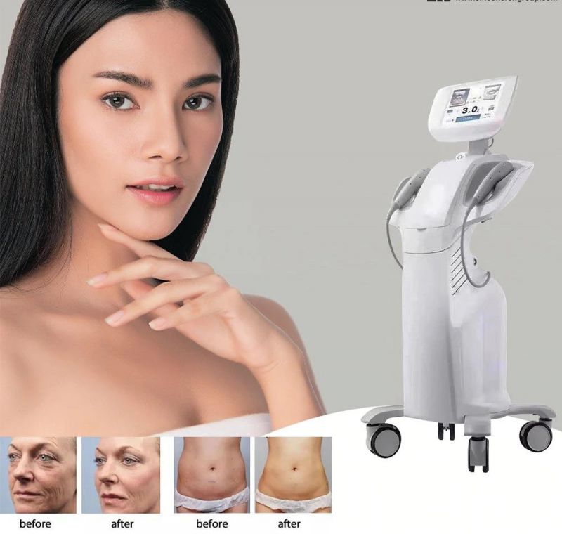 Consultant Dr. High Quality Hifu Machine Ultra Sincoheren Korea Hifu 7D Anti-Wrinkle Machine Anti Aging Face Lifting Skin Tightening Former