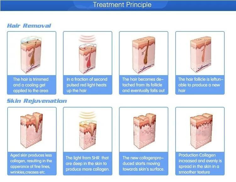 Opt+Shr+Dpl Multi-Functional Depilation Skincare Beauty Equipment