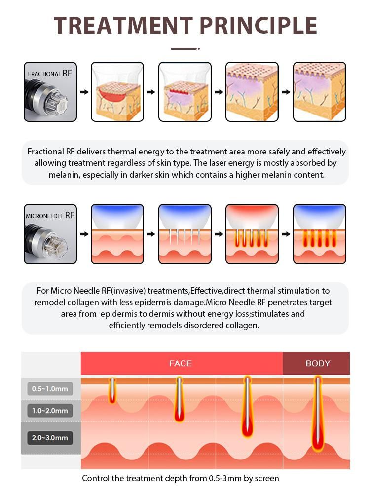 Face Lifting RF Fractional Scar Wrinkle Removal Skin Tightening Acne