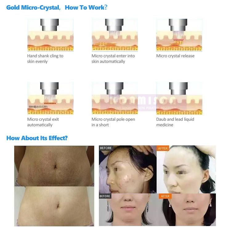 Facial Beauty Instrument RF Skin Care Microneedle Machine