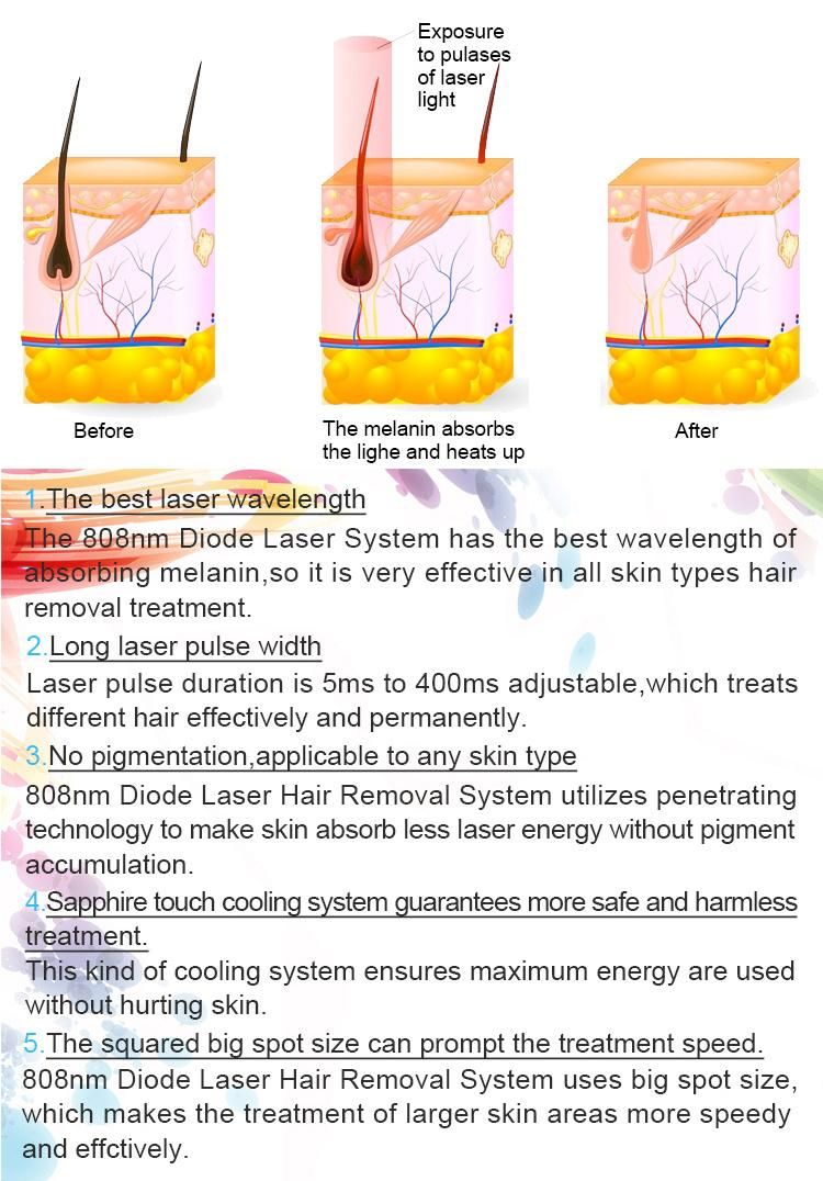 2019 Professional Permanent Hair Removal Diode Laser Hair Removal Device/808nm Ice -4º C