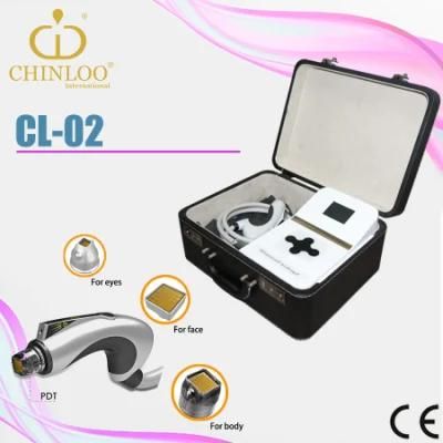 Chinloo 2016 Portable Superficial RF Skin Lifting Beauty Machine for Wrinkle Removal (CL-02)