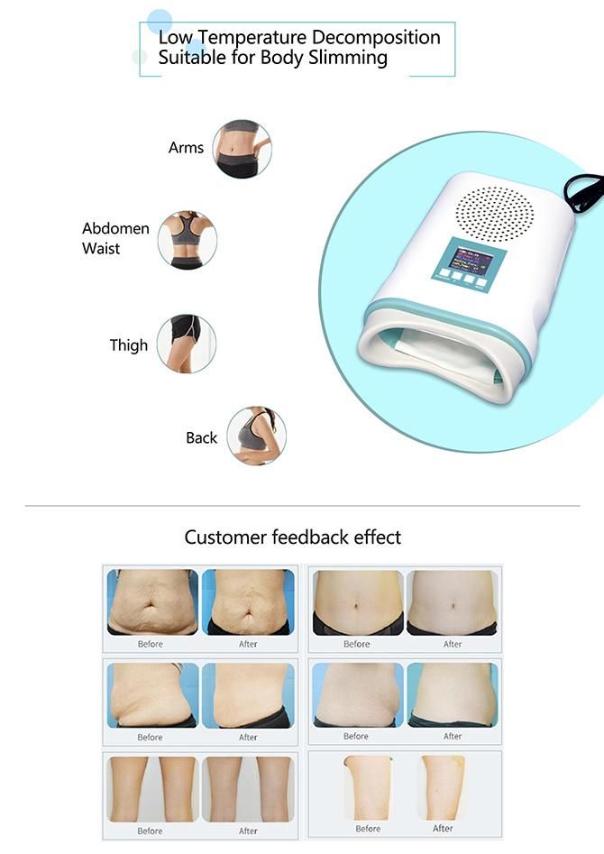 Home Slimming Portable Vacuum Fat Freezer Minin Cryolipolysis Device