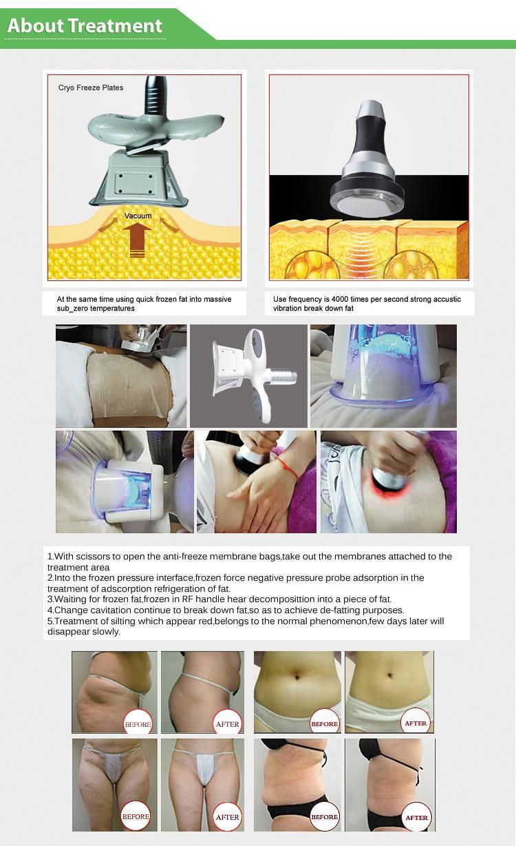 Cryo Slimming Machine New 4 Cryo Handles Cryolipolysis for Body/Belly/Buttocks