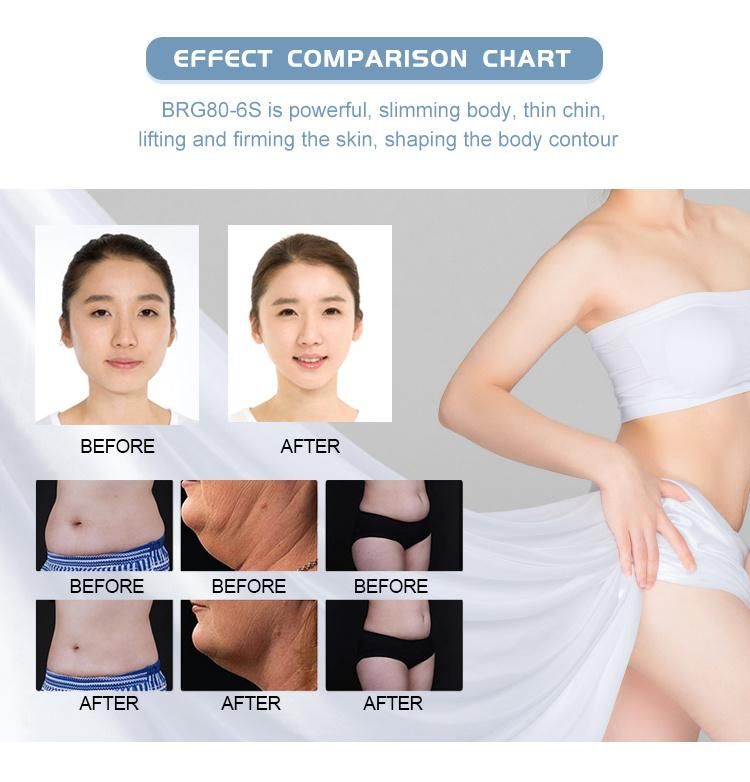 Cooling Fat to Loss Body Sculpting Cryolipolysis with Dual Handles Work Together