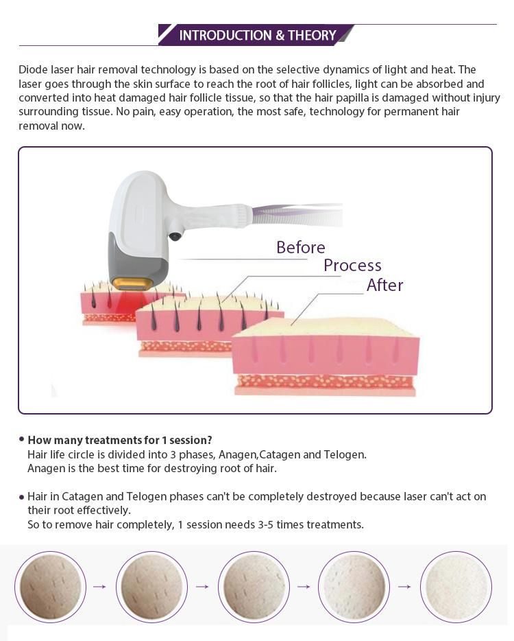 Diode Laser Hair Removal Machine