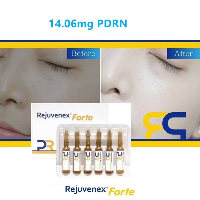 High-End Brand Pdrn Dermal Filler Rejuvenex Forte Price Rejuran High Pdrn Contents 2.5ml*6 Double The Effect Incremental The King of Cost Performance Placentex