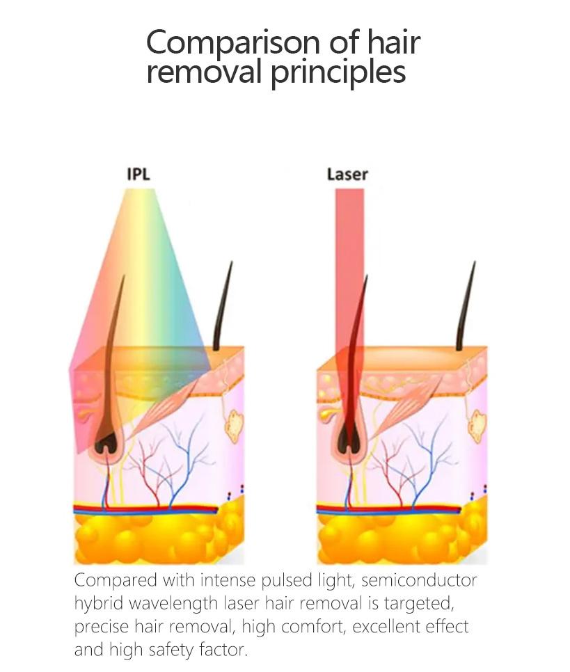 The Hottest Beauty Machine 3 Wavelength Laser Equipment and Permanent Laser Hair Removal Machine