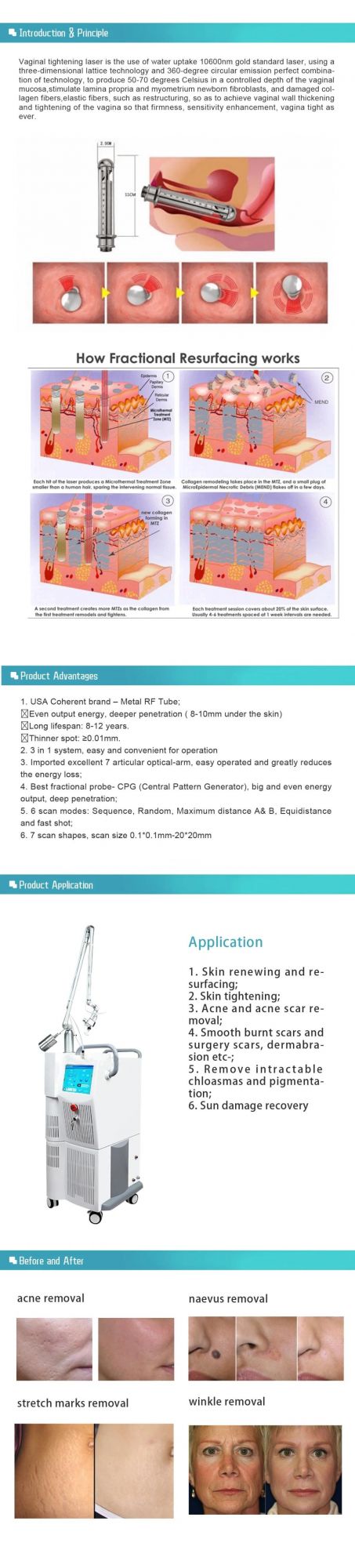 Fractional CO2 Laser Machine 10600nm Wavelength for Skin Rejuvenation