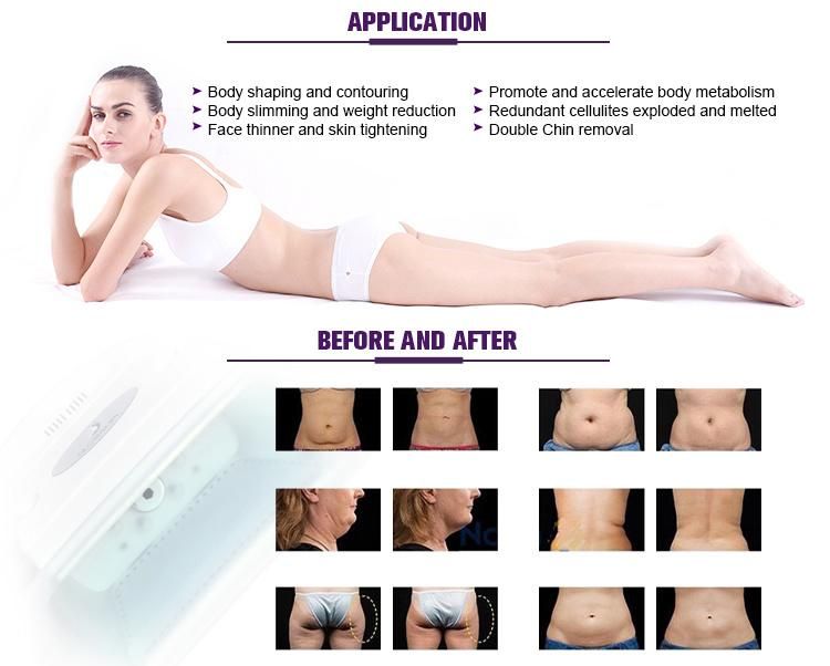 Body Slimming Cryo Therapy Fat Freezing Machine with Laser Cavitation Handle