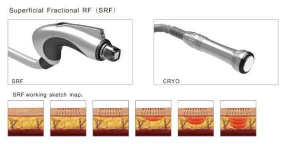 Magical Effect Cryolipolysis Fractional RF Microneedle Beauty Machine (Mr18-2s/CE)