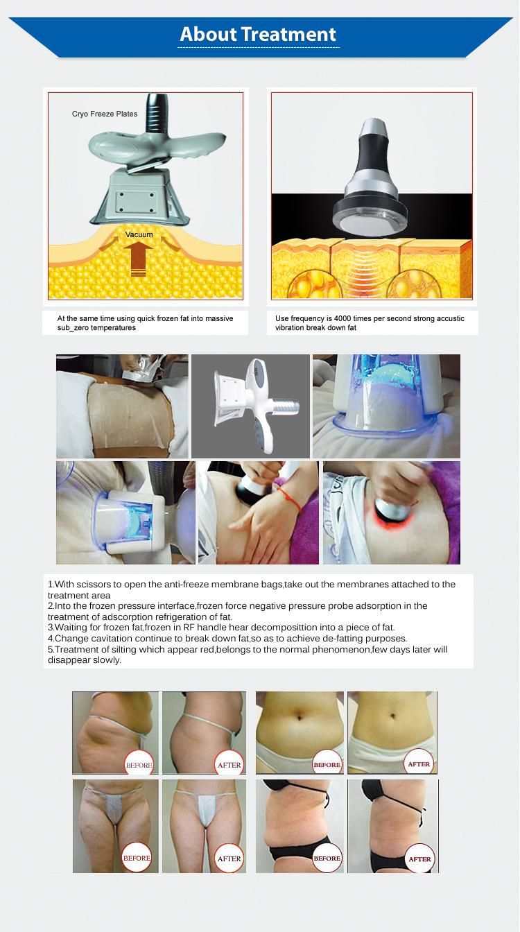 4 in 1 Cryolipolysis Freeze Fat Machine with Vacuum Cavitation System