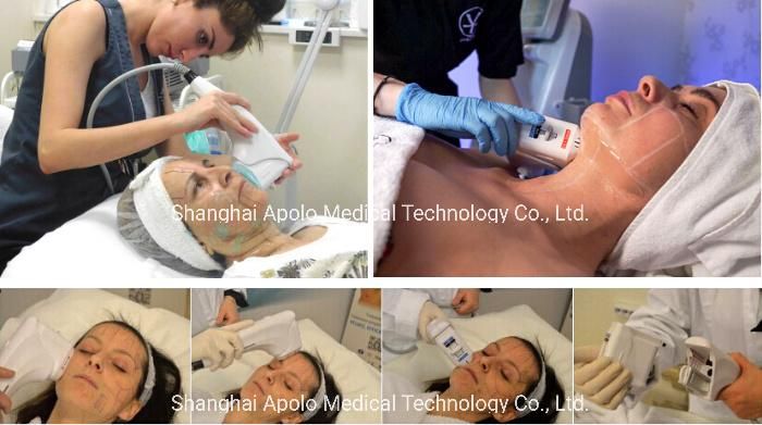 Apolo Factory High Quality   Ultrasound Therapy Hifu Hifu Machine for Face Lift HS-510