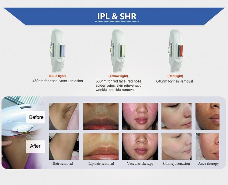 Shr Beauty Elight Opt Hair Removal Machine for Skin Rejuvenation