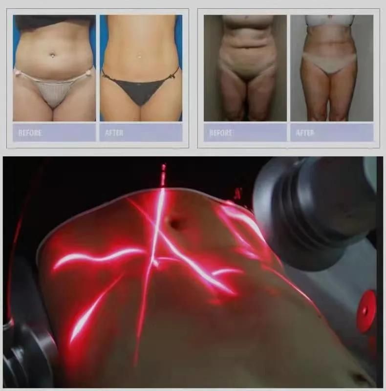 2022 Newest Design 635nm Red Light Lipo Laser Weight Loss Non-Invasive 532nm Wavelength 6D Laser Non-Thermal Slimming Machine