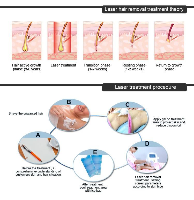 Professional Epilator System portable 808nm Diode Laser America FDA Approved